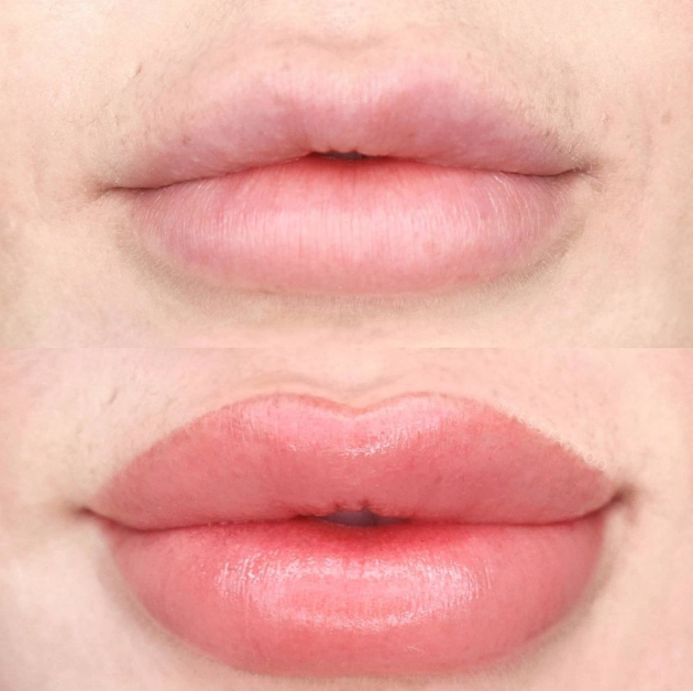 block image