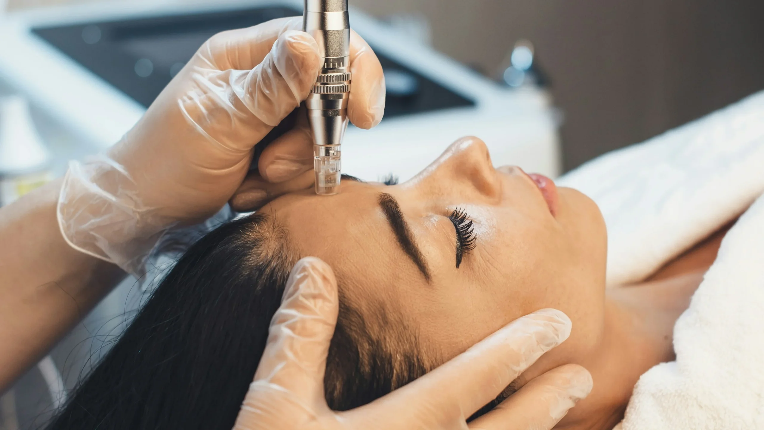 Close-up van een professionele microneedlingbehandeling op het gezicht van een vrouw in een salon