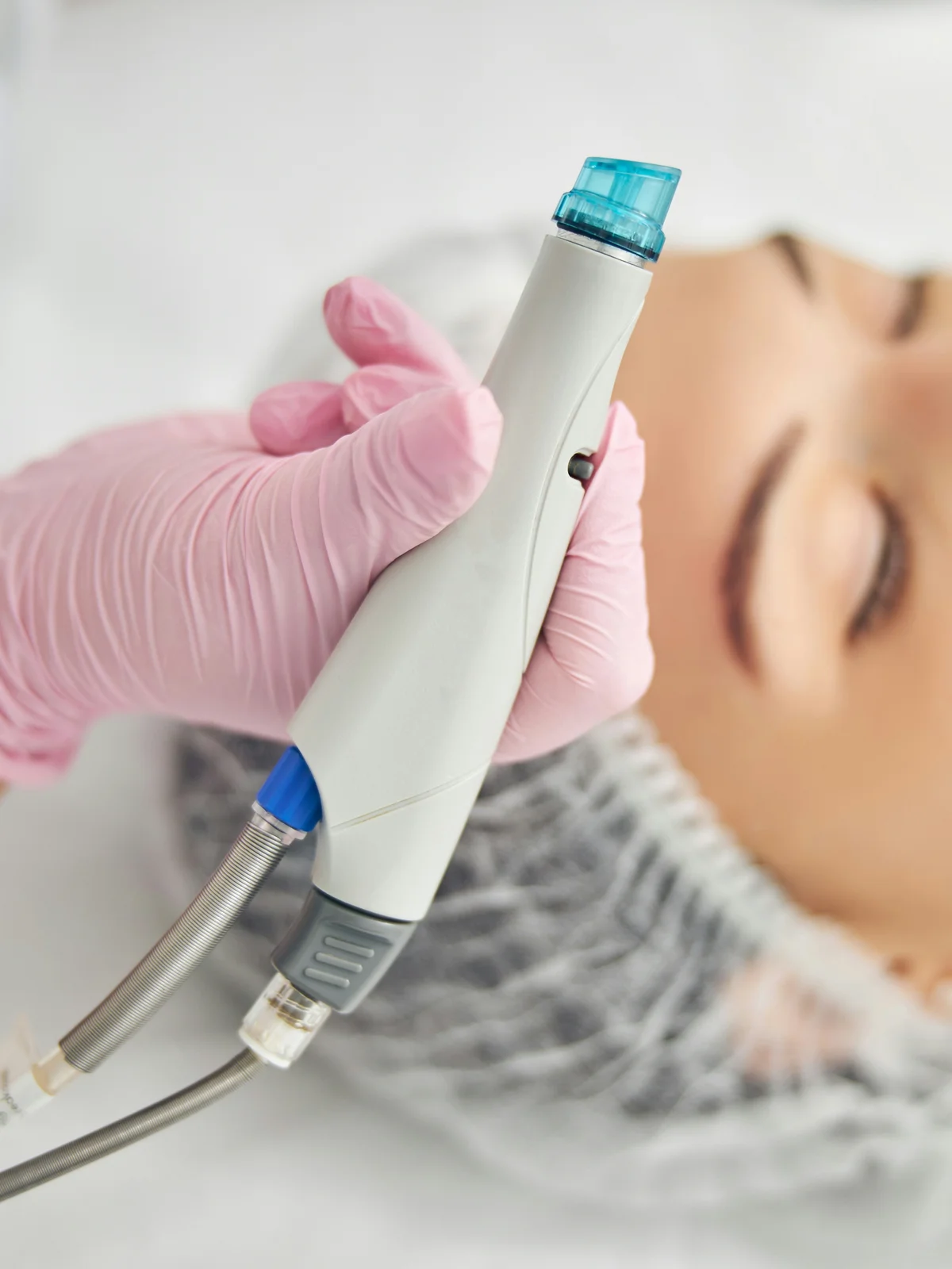 Close-up van een HydraFacial-apparaat met spiraalvormig opzetstuk, vastgehouden door een specialist
