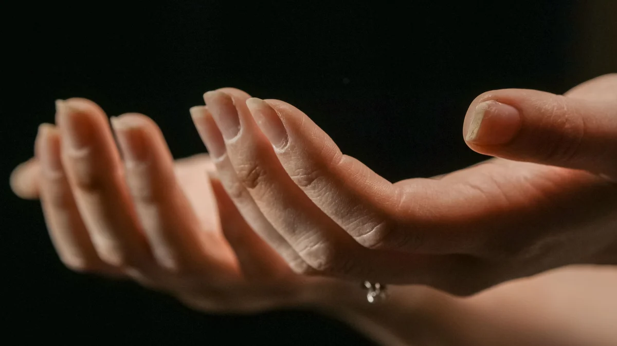 Twee handen naar voren gestrekt met de handpalmen omhoog en afbladderende nagels