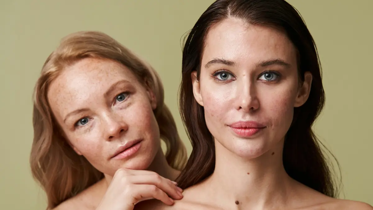 Een blonde vrouw met sproeten kijkt vanachter een donkerharige vrouw met een acnehuid vandaan